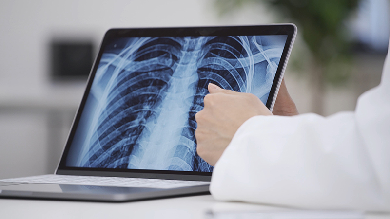 01. 呼吸器専門医による確かな診断と根本治療